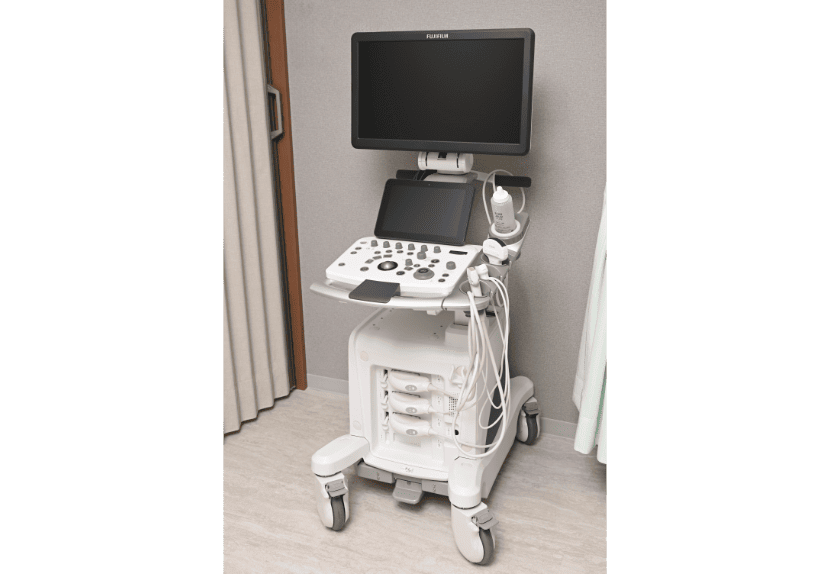 超音波診断装置